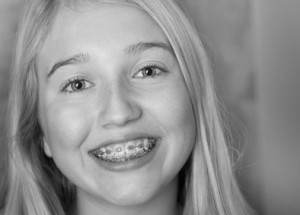 teen girl with braces on her teeth
